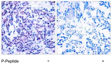 Anti-JunD (phospho Ser255) antibody used in IHC (Paraffin sections) (IHC-P). GTX79026