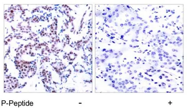 Anti-JunB (phospho Ser259) antibody used in IHC (Paraffin sections) (IHC-P). GTX79027