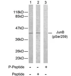 Anti-JunB (phospho Ser259) antibody used in Western Blot (WB). GTX79027