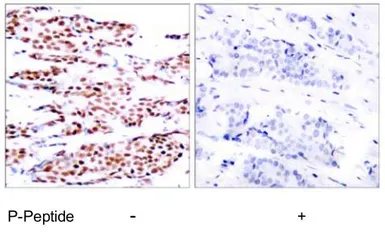 Anti-JunB (phospho Ser79) antibody used in IHC (Paraffin sections) (IHC-P). GTX79028