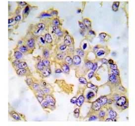 Anti-IRS1 (phospho Ser616) antibody used in IHC (Paraffin sections) (IHC-P). GTX79033