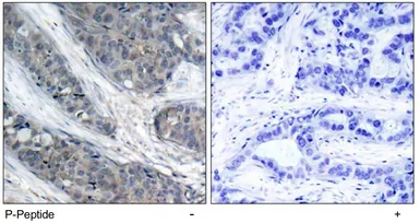 Anti-IRS1 (phospho Ser307) antibody used in IHC (Paraffin sections) (IHC-P). GTX79034