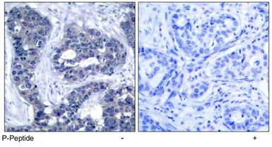 Anti-IRS1 (phospho Ser639) antibody used in IHC (Paraffin sections) (IHC-P). GTX79035