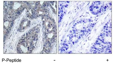 Anti-IRS1 (phospho Ser636) antibody used in IHC (Paraffin sections) (IHC-P). GTX79037