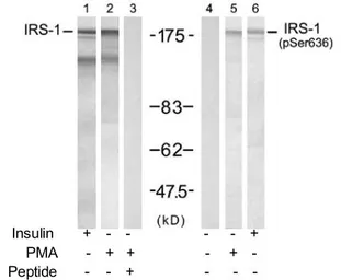 Anti-IRS1 (phospho Ser636) antibody used in Western Blot (WB). GTX79037