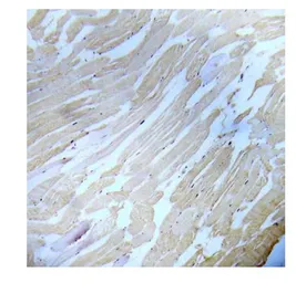 Anti-IKK alpha (phospho Ser180) + IKK beta (phospho Ser181) antibody used in IHC (Paraffin sections) (IHC-P). GTX79040