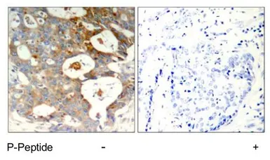 Anti-IKB epsilon (phospho Ser22) antibody used in IHC (Paraffin sections) (IHC-P). GTX79041