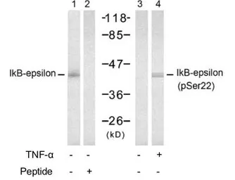 Anti-IKB epsilon (phospho Ser22) antibody used in Western Blot (WB). GTX79041