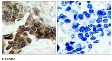 Anti-IKB alpha (phospho Ser32/Ser36) antibody used in IHC (Paraffin sections) (IHC-P). GTX79042