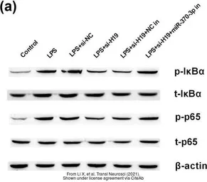 Anti-IKB alpha (phospho Ser32/Ser36) antibody used in Western Blot (WB). GTX79042