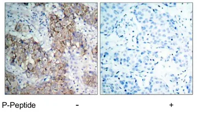 Anti-IGF1R beta (phospho Tyr1131) / Insulin Receptor beta (phospho Tyr1146) antibody used in IHC (Paraffin sections) (IHC-P). GTX79046