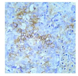 Anti-IGF1R beta (phospho Tyr950) antibody used in IHC (Paraffin sections) (IHC-P). GTX79047