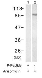 Anti-GRP94 (phospho Ser254) antibody used in Western Blot (WB). GTX79049