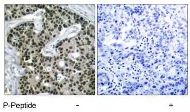 Anti-HSF1 (phospho Ser303) antibody used in IHC (Paraffin sections) (IHC-P). GTX79051
