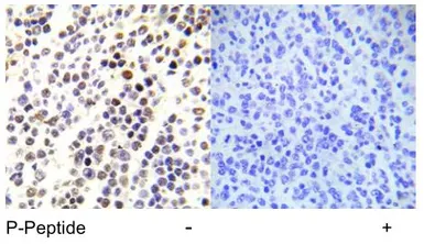 Anti-Histone H3S28ph (phospho Ser28) antibody used in IHC (Paraffin sections) (IHC-P). GTX79053