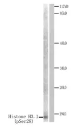 Anti-Histone H3S28ph (phospho Ser28) antibody used in Western Blot (WB). GTX79053