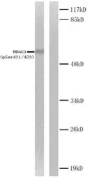 Anti-HDAC1 (phospho Ser421/Ser423) antibody used in Western Blot (WB). GTX79062