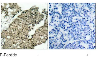 Anti-G3BP1 (phospho Ser232) antibody used in IHC (Paraffin sections) (IHC-P). GTX79070