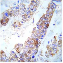 Anti-FYN (phospho Tyr530) antibody used in IHC (Paraffin sections) (IHC-P). GTX79071