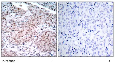 Anti-Estrogen Receptor alpha (phospho Ser104) antibody used in IHC (Paraffin sections) (IHC-P). GTX79081