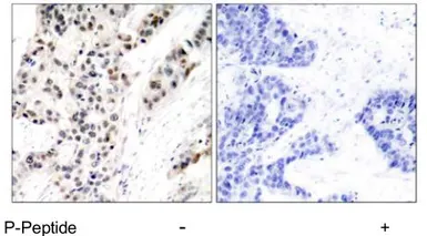 Anti-Estrogen Receptor alpha (phospho Ser106) antibody used in IHC (Paraffin sections) (IHC-P). GTX79082