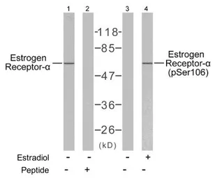 Anti-Estrogen Receptor alpha (phospho Ser106) antibody used in Western Blot (WB). GTX79082