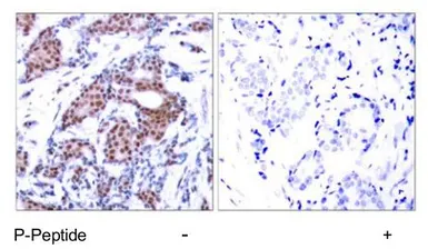 Anti-ELK1 (phospho Ser383) antibody used in IHC (Paraffin sections) (IHC-P). GTX79084