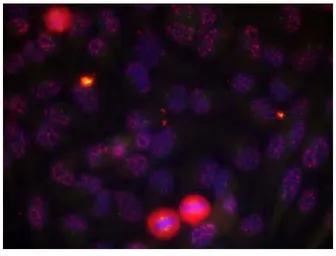 Anti-ELK1 (phospho Thr417) antibody used in Immunocytochemistry/ Immunofluorescence (ICC/IF). GTX79085