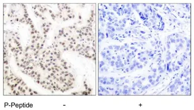 Anti-ELK1 (phospho Thr417) antibody used in IHC (Paraffin sections) (IHC-P). GTX79085
