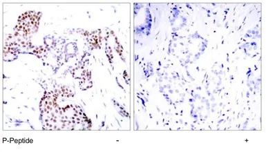 Anti-ELK1 (phospho Ser389) antibody used in IHC (Paraffin sections) (IHC-P). GTX79086
