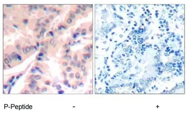 Anti-eIF4B (phospho Ser422) antibody used in IHC (Paraffin sections) (IHC-P). GTX79088