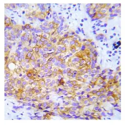 Anti-CrkL (phospho Tyr207) antibody used in IHC (Paraffin sections) (IHC-P). GTX79096