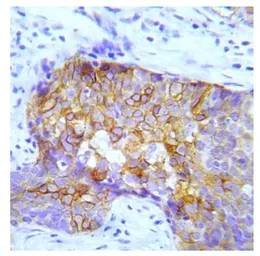 Anti-CRK (phospho Tyr221) antibody used in IHC (Paraffin sections) (IHC-P). GTX79097