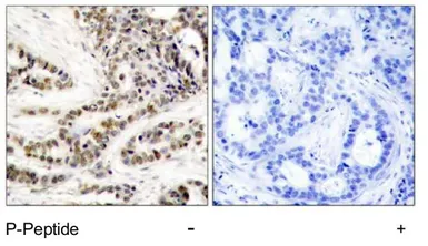 Anti-CREB (phospho Ser129) antibody used in IHC (Paraffin sections) (IHC-P). GTX79099