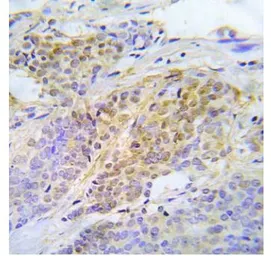 Anti-Chk2 (phospho Thr387) antibody used in IHC (Paraffin sections) (IHC-P). GTX79109