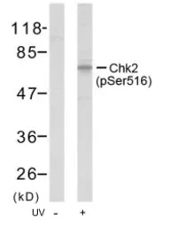 Anti-Chk2 (phospho Ser516) antibody used in Western Blot (WB). GTX79110