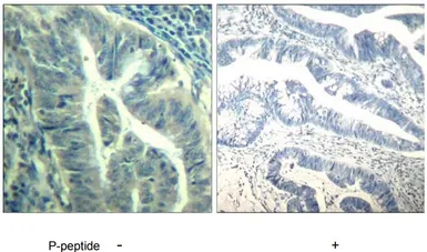Anti-CDK6 (phospho Tyr24) antibody used in IHC (Paraffin sections) (IHC-P). GTX79112