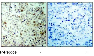 Anti-CDK2 (phospho Thr160) antibody used in IHC (Paraffin sections) (IHC-P). GTX79113