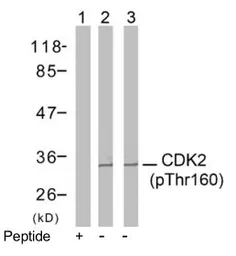 Anti-CDK2 (phospho Thr160) antibody used in Western Blot (WB). GTX79113