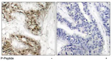 Anti-CDC25C (phospho Ser216) antibody used in IHC (Paraffin sections) (IHC-P). GTX79114