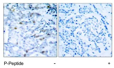 Anti-CDC2 (phospho Thr161) antibody used in IHC (Paraffin sections) (IHC-P). GTX79115