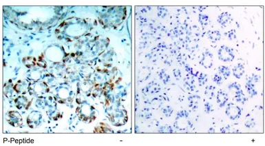 Anti-Bim (phospho Ser69/Ser65) antibody used in IHC (Paraffin sections) (IHC-P). GTX79122