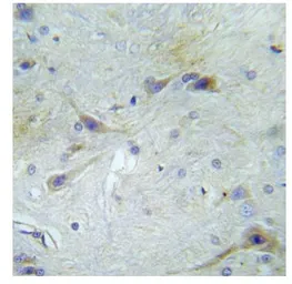 Anti-APP (phospho Thr743/Thr668) antibody used in IHC (Paraffin sections) (IHC-P). GTX79123