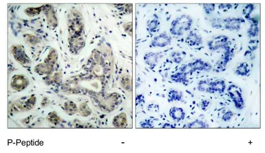 Anti-Bad (phospho Ser136) antibody used in IHC (Paraffin sections) (IHC-P). GTX79125