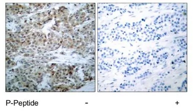Anti-Bad (phospho Ser112) antibody used in IHC (Paraffin sections) (IHC-P). GTX79127