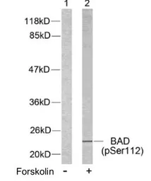 Anti-Bad (phospho Ser112) antibody used in Western Blot (WB). GTX79127