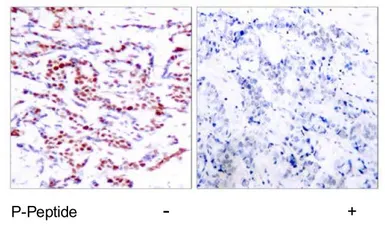 Anti-ATF2 (phospho Thr71) antibody used in IHC (Paraffin sections) (IHC-P). GTX79133