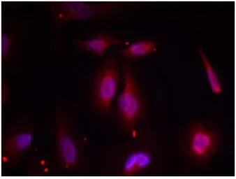 Anti-ATF2 (phospho Thr69) antibody used in Immunocytochemistry/ Immunofluorescence (ICC/IF). GTX79134