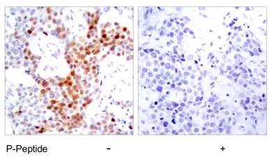 Anti-ATF2 (phospho Thr69) antibody used in IHC (Paraffin sections) (IHC-P). GTX79134