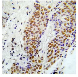 Anti-ASK1 (phospho Ser966) antibody used in IHC (Paraffin sections) (IHC-P). GTX79136